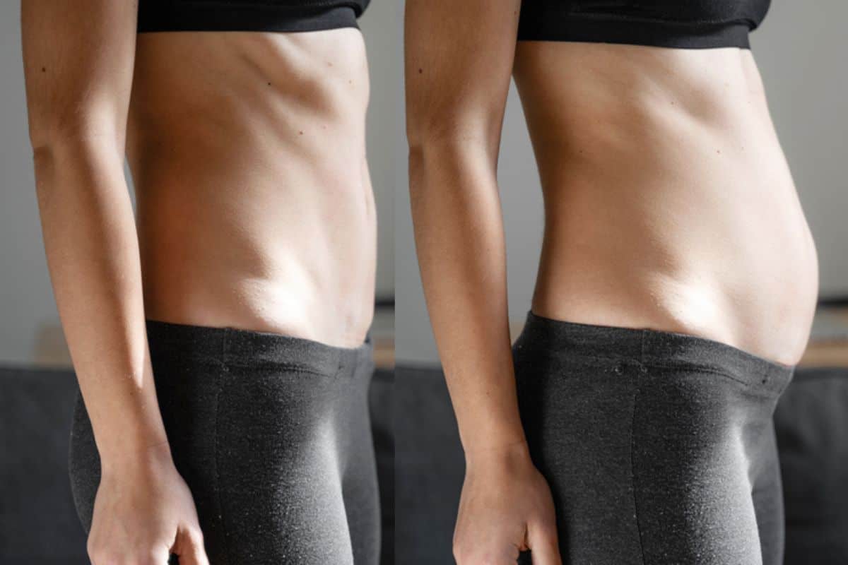 How long does diastasis recti take to improve Wales?