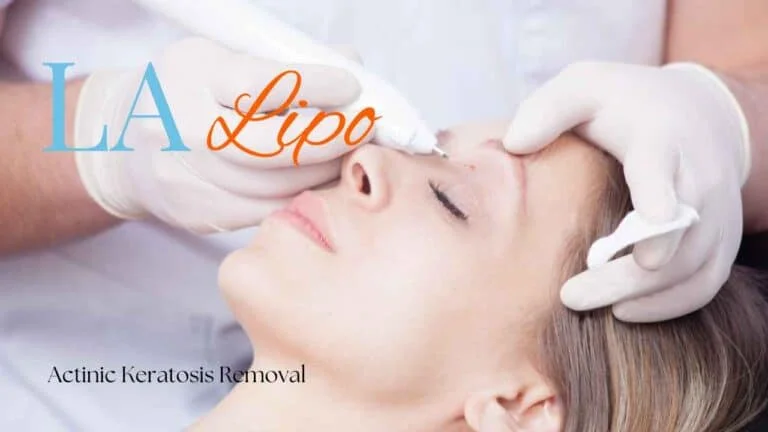 Woman receiving Actinic Keratosis Removal Treatment Wales