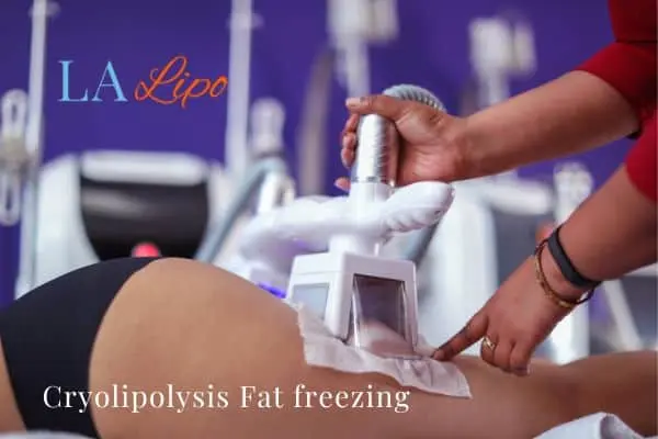 women getting fat freezing Wales