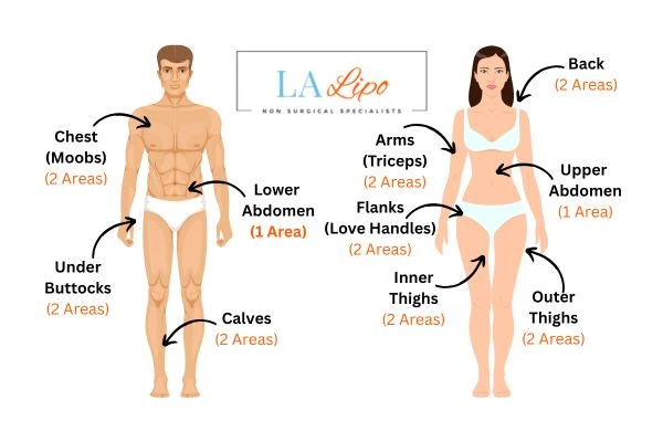 LA LIPO Cryolipolysis Areas Wales