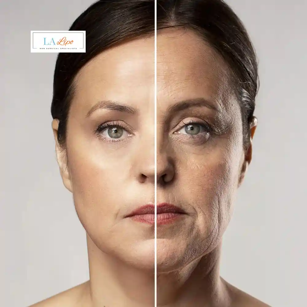 How Can You Tell If Non-Surgical Skin Tightening Is Right for You Wales?