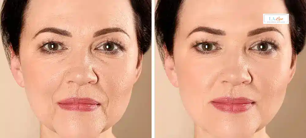 How Long Does It Take to See Results and How Long Do They Last Wales?