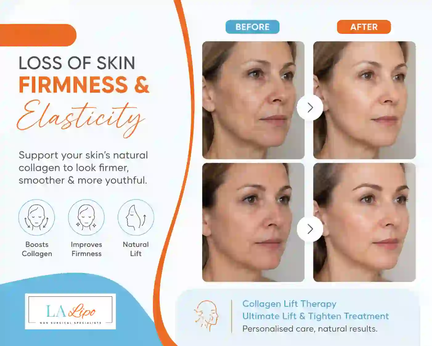 Sign #7: Loss of Skin Firmness and Elasticity Wales
