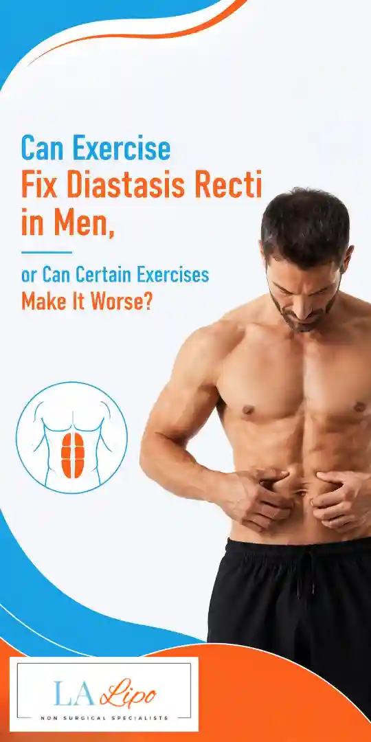 Can Exercise Fix Diastasis Recti in Men, or Can Certain Exercises Make It Worse Wales?